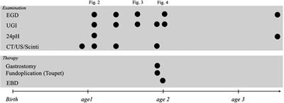 Case Report: The importance of early intervention for gastroesophageal reflex disease caused by hiatal hernia